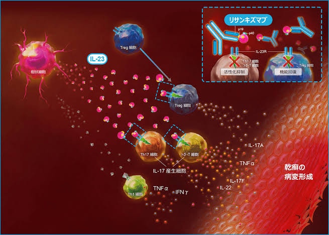 スキリジ vs. トレンフィア